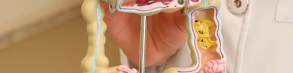 cancer_colorretal Modelo de Câncer Colorretal