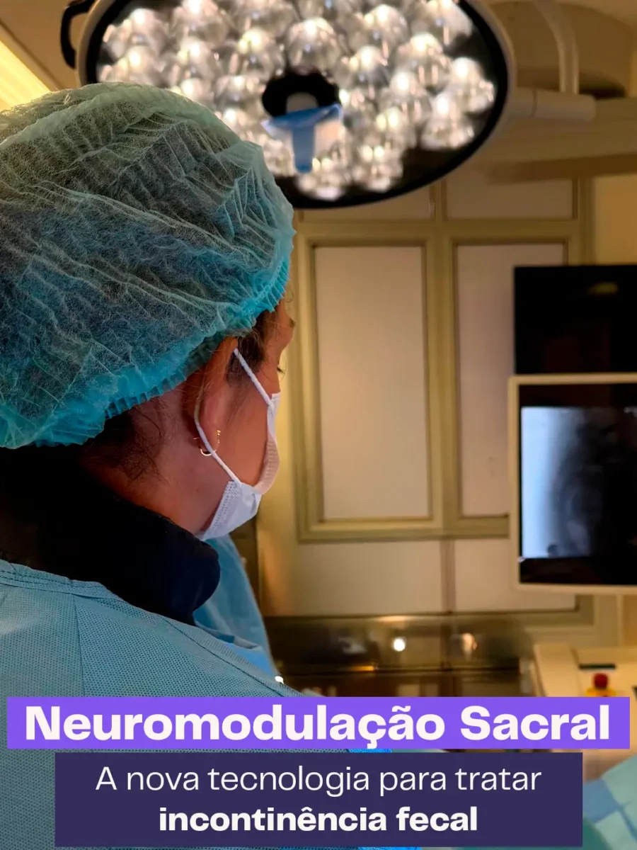 Procedimento de Neuromodulação Sacral