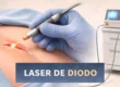 Laser de Diodo