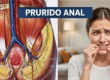 Prurido Anal