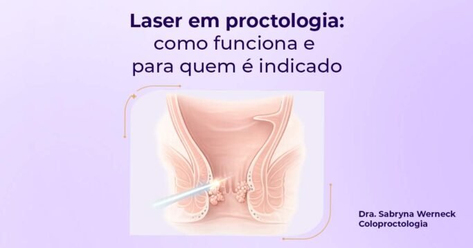 Laser em proctologia como funciona