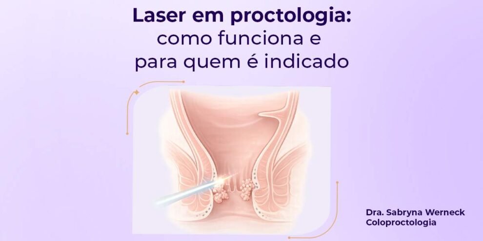 Laser em proctologia como funciona