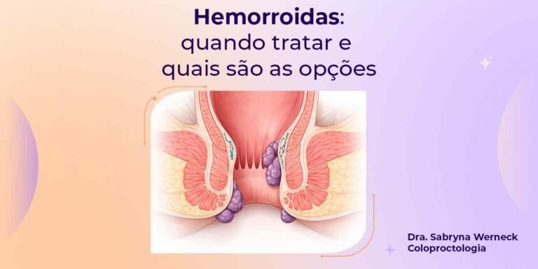 Hemorroidas internas e externas com indicação de quando tratar e opções de tratamento
