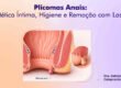 Plicomas Anais