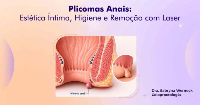 Plicomas Anais
