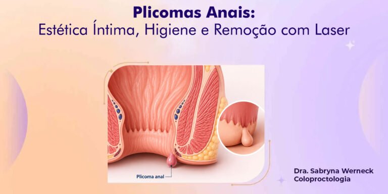 Plicomas Anais